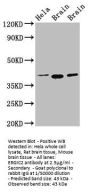 ERGIC2 Antibody