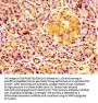 ERGIC2 Antibody