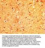 MYO5A Antibody