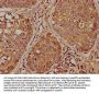 PAFAH2 Antibody