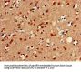 FOXC2 Antibody