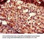 FOXC2 Antibody