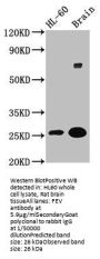 FEV Antibody