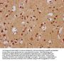 FEV Antibody