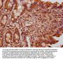 FEV Antibody