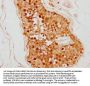 TSNAX Antibody