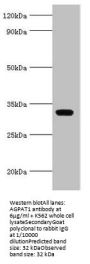 AGPAT1 Antibody