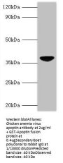 Rabbit anti-Chicken anemia virus apoptin polyclonal Antibody