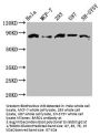 BARD1 Antibody