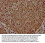 HIST1H2BL Antibody