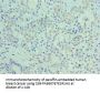 PLIN2 Antibody