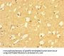 RIT2 Antibody