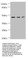 ACY1 Antibody