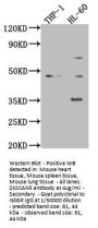 ZKSCAN3 Antibody