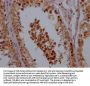 CHCHD5 Antibody