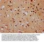 FSD1 Antibody