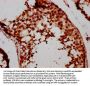 FSD1 Antibody