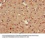 GABARAPL1 Antibody