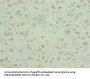 KCNK13 Antibody