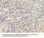 IL21R Antibody
