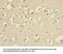 IL21R Antibody