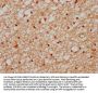 XAB2 Antibody