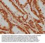 XAB2 Antibody
