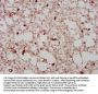 PCGF1 Antibody