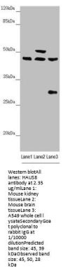 HAUS8 Antibody