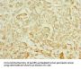 TTLL2 Antibody