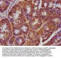 CARD6 Antibody