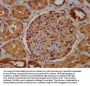 RAB11FIP5 Antibody