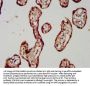 RAB11FIP5 Antibody