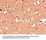 PINK1 Antibody