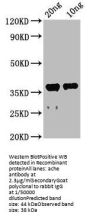 ache Antibody