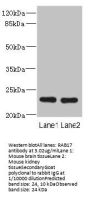 RAB17 Antibody
