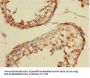 CSRNP2 Antibody