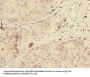 GDPD2 Antibody
