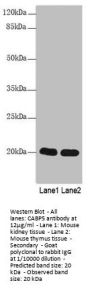 CABP5 Antibody