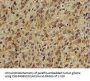 PLCB1 Antibody