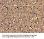 PLCB1 Antibody
