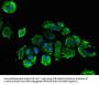 PLCB1 Antibody