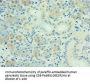 Rabbit anti-human Serine/threonine-protein kinase PAK 6 polyclonal Antibody(PAK6)