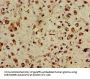 ASH1L Antibody