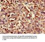 ASH1L Antibody
