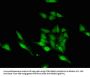 ASH1L Antibody