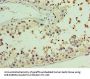 AASDHPPT Antibody