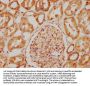 TBC1D23 Antibody
