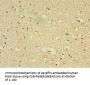 FLRT1 Antibody