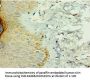 IL36RN Antibody